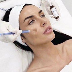 Jet Peel visage complet  et cou : Rides - Tâches - Rougeurs etc