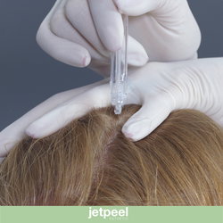 Jet Peel Cuir Chevelu + LED