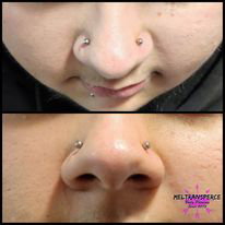 Double nez