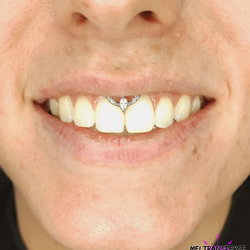 Smiley