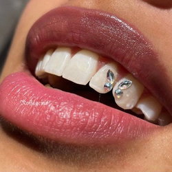 STRASS DENTAIRE EFFET PAPILLONS