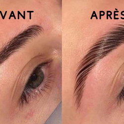 Brownlift