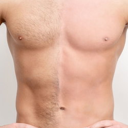 Torse