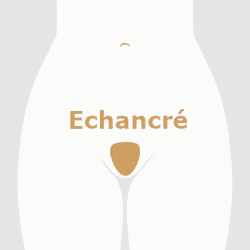 Epilation Maillot Echancré
