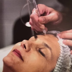 Jet Peel Visage et Cou +LED