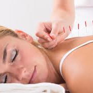 ACUPUNCTURE