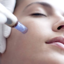 Microneedling - bb glow  : soin régénérant, ridules, tâches et cicatrices
