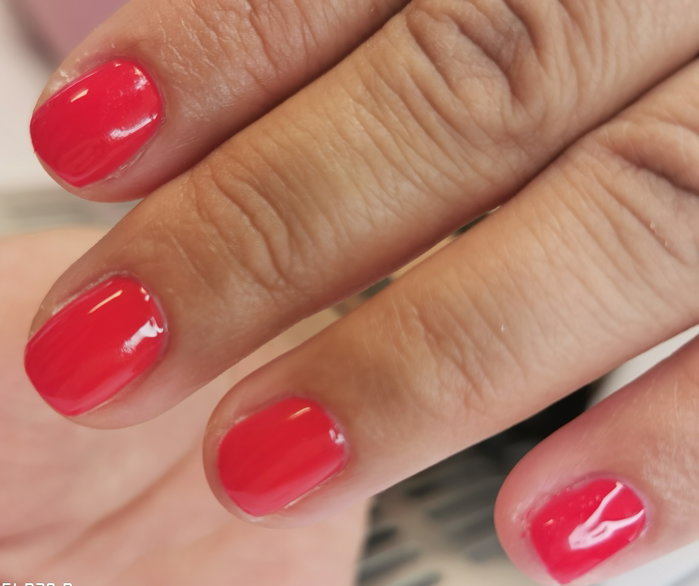 graine d'ongles : photo 2