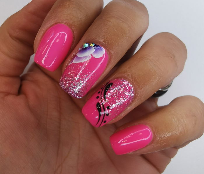 graine d'ongles à Genève RDV360