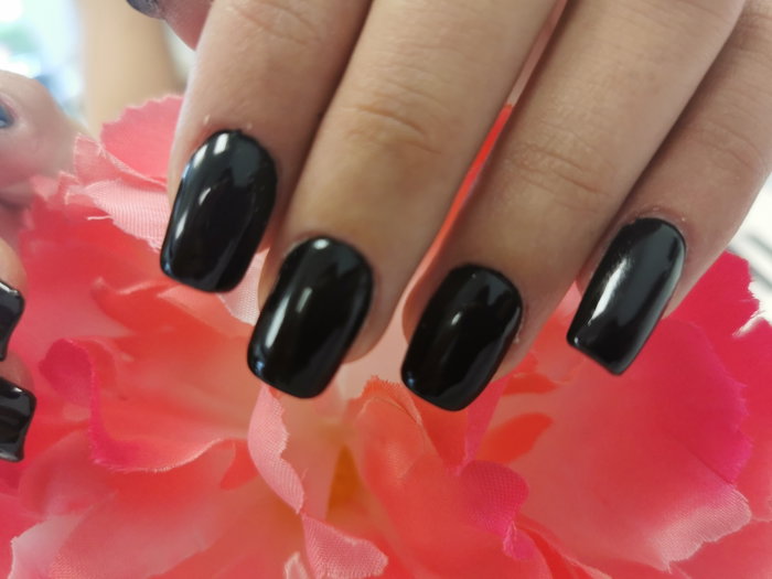 graine d'ongles : photo 5