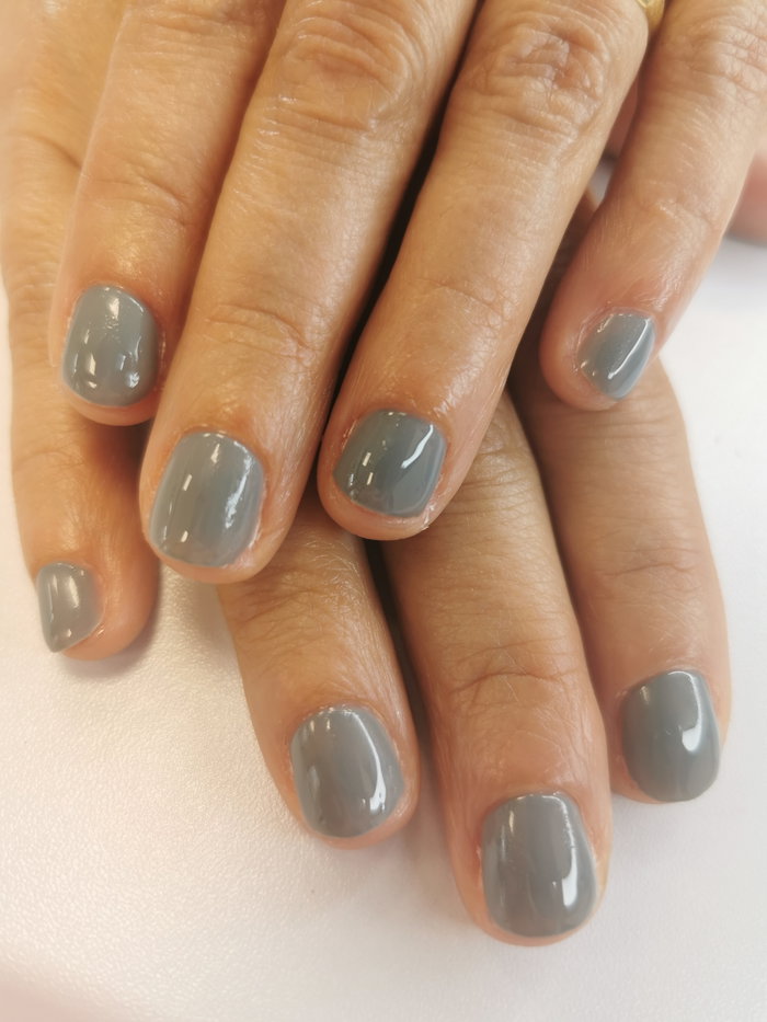 graine d'ongles : photo 7