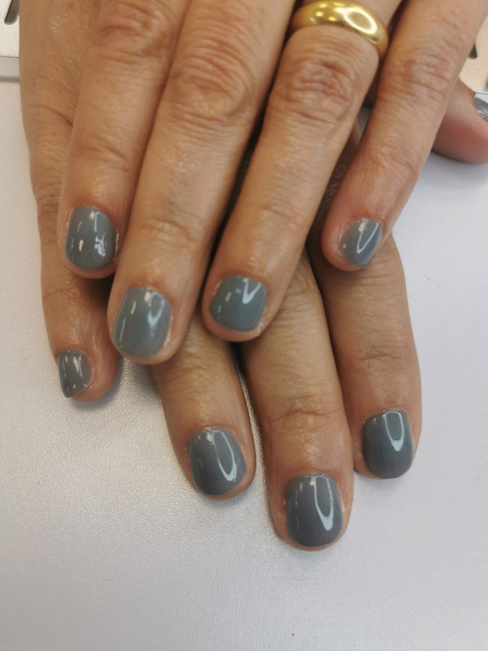 graine d'ongles : photo 8