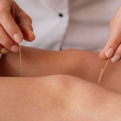 Consultation de Médecine Traditionnelle Chinoise - Séances rapprochée (moins d'1 semaine)