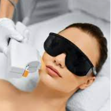visage vaisseaux - taches - 2 zones( menton / lèvre sup / joues / front )