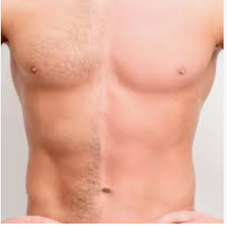 Abdomen