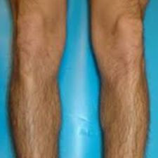 jambe entière