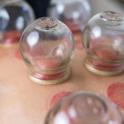 Séance de Réflexologie avec pose de Ventouses
